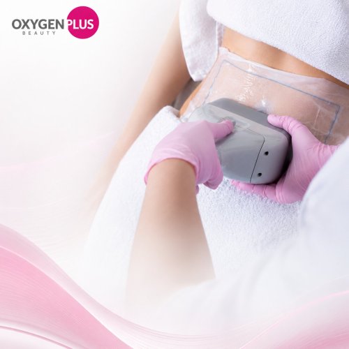 cryolipolysis