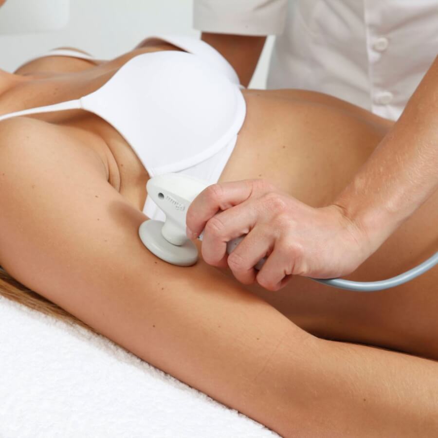 SYMMED ΧΕΡΙΑ SYMMED Medical RF - χέρια