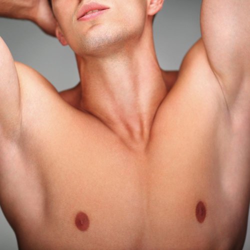 Laser αποτρίχωση στήθος 3 +1 συνεδρίες