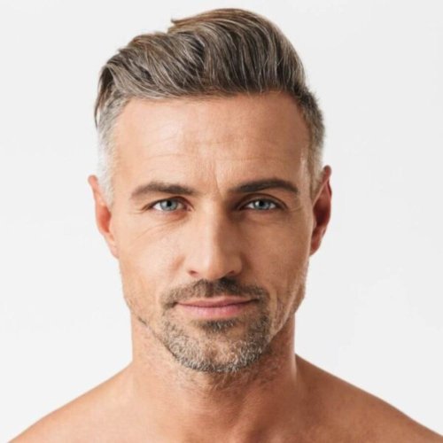 Laser αποτρίχωση μεσόφρυο & αφτιά 3 +1 συνεδρίες