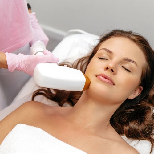 LASER αποτρίχωση πηγούνι 3+1 συνεδρίες