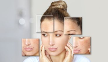 Skin boosters