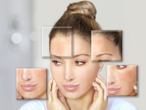 Skin Boosters: Η Νέα Γενιά Αναζωογόνησης του Δέρματος